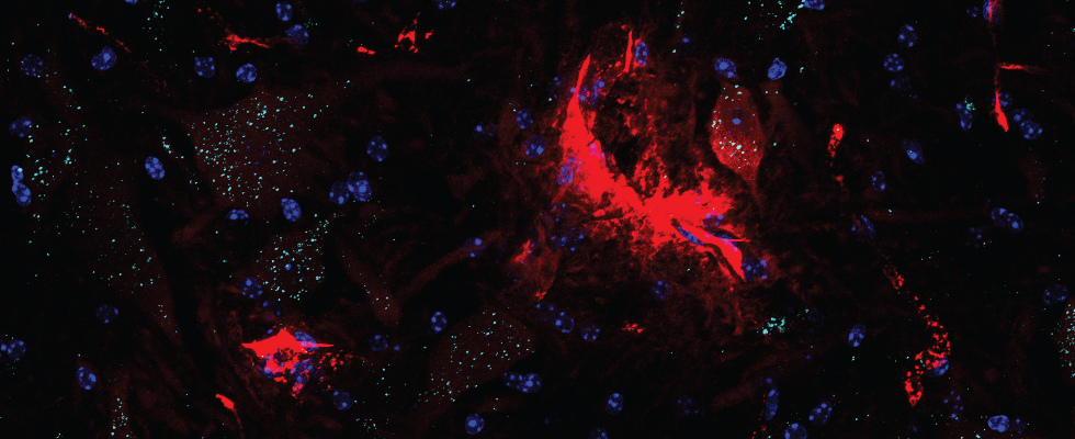 Microscopy image of the spinal cord.