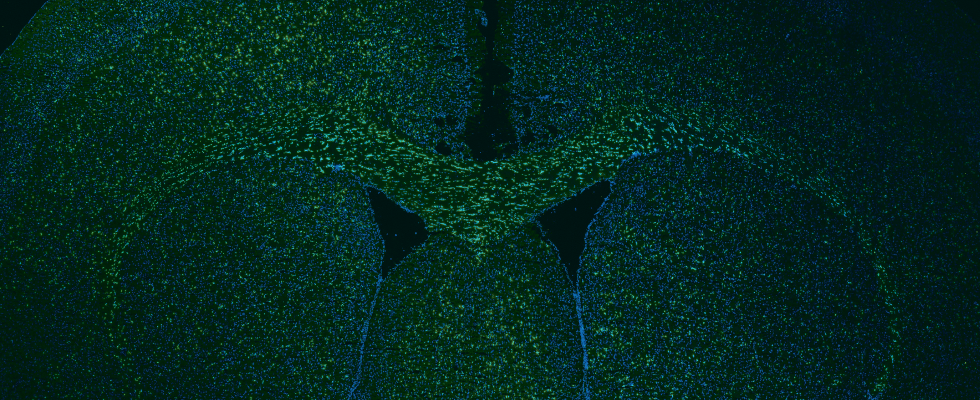 Microscopy image of the mouse brain.