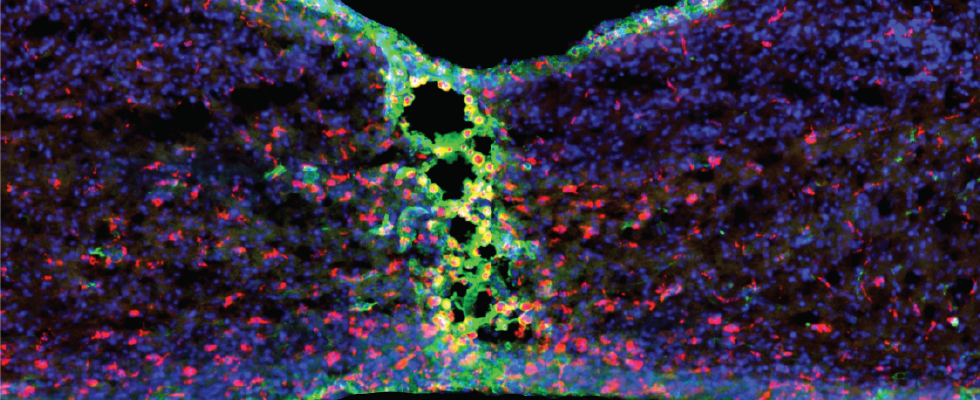 Microscopy image of mouse spinal cord.